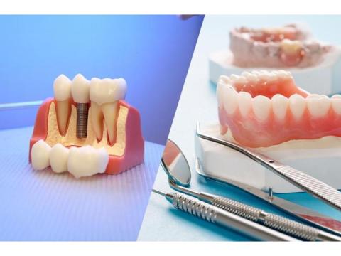 How long do dentures implants last? - 2/2