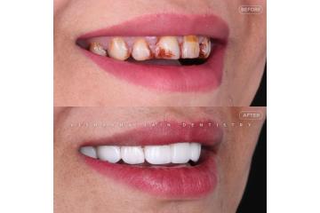 Indore Dentist Best | Expert Dental Care for Healthy Smiles