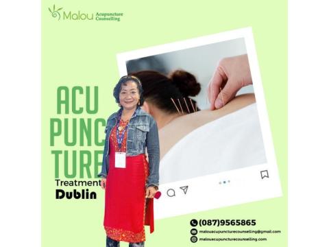 De-stress with Acupuncture Treatment That Harmonises Body & Mind