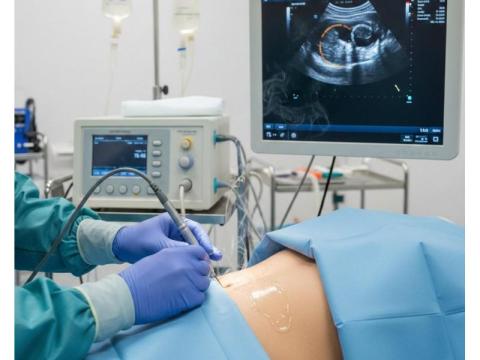 Radiofrequency Ablation Treatment RFA Cost in India | Picture This 