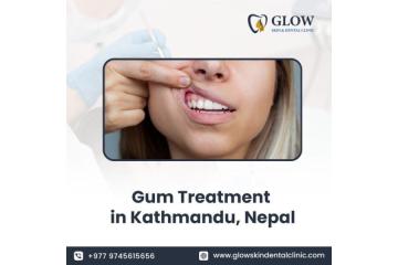Gum Treatment in Kathmandu, Nepal