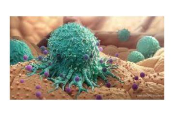 Prostate Cancer Treatment in Delhi NCR