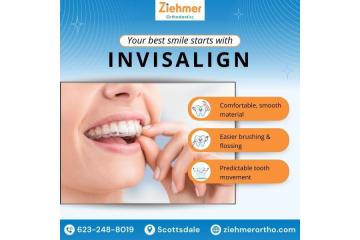 Invisalign North Scottsdale