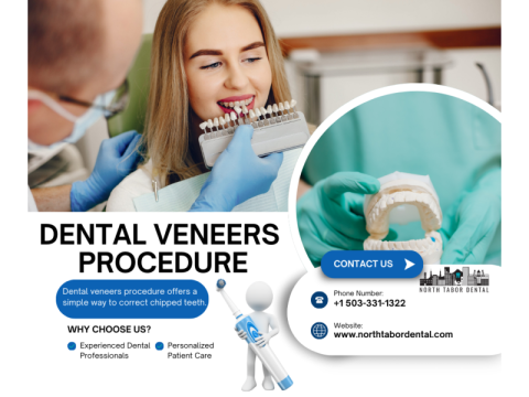 Is Dental Veneers Procedure Painful ?