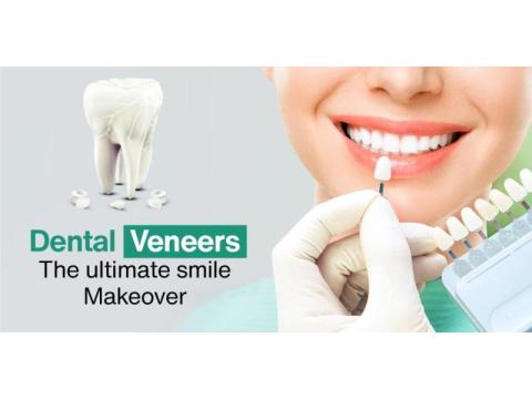 Is Dental Veneers Procedure Painful ? - 2/2