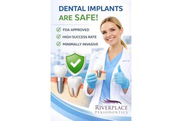Trusted by Millions: The Safety of Modern Dental Implants
