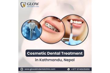 Cosmetic Dental Treatment in Kathmandu, Nepal