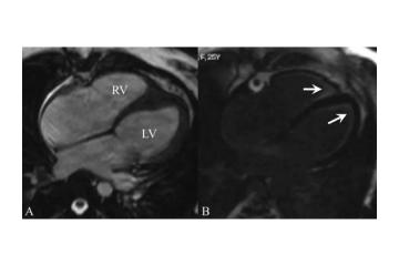 Same Day Reports - Cardiac MRI Scan in Mumbai by Picture This 