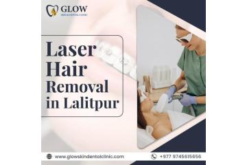 Best Laser Hair Removal in Lalitpur