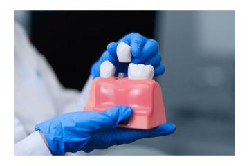 Why Orthodontics Melbourne Is Best for You