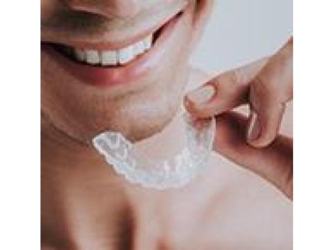 Affordable Mouth Guards Melbourne for Every Need