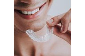 Affordable Mouth Guards Melbourne for Every Need