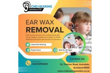 Are You looking for best Ear wax Removal throughout Auckland?