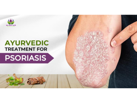 How Ayurvedic Psoriasis Treatment Improves Skin Health