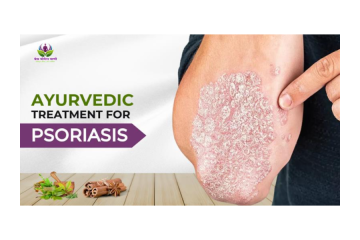 How Ayurvedic Psoriasis Treatment Improves Skin Health
