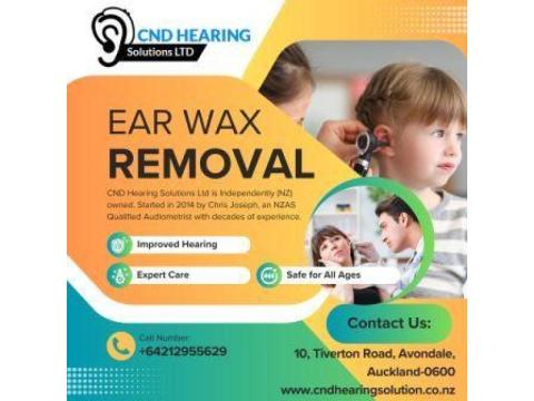 Are you Need for Ear Wax Removal in Auckland?