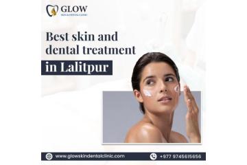 Best Skin and Dental Treatment in Lalitpur