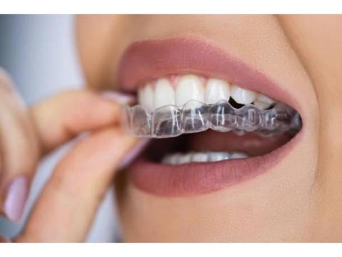 Achieve Perfect Alignment with Lake Oswego Orthodontics