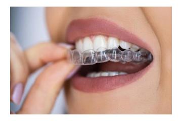 Achieve Perfect Alignment with Lake Oswego Orthodontics