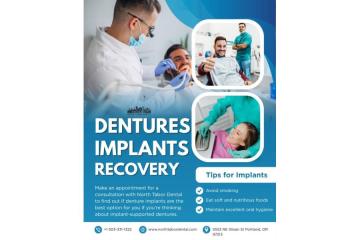 Are denture implants worth it?