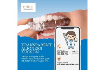 Transparent Aligners in Tucson