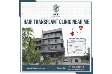 best hair transplant clinic in India