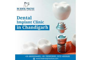 Best Dental Implant Clinic in Chandigarh