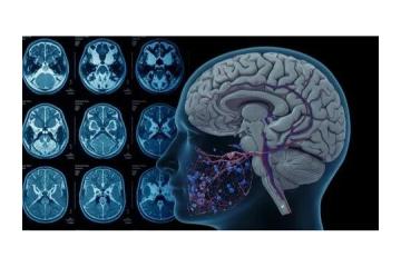 Functional MRI Brain Mapping in Mumbai - Picture This 