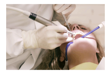 Advanced Laser Gum Treatment for Better Oral Care