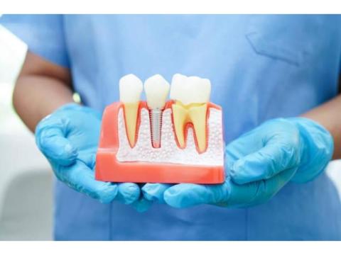 Advanced Laser Gum Treatment for Better Oral Care - 2/2