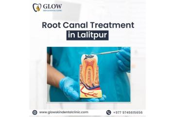 Root Canal Treatment in Lalitpur