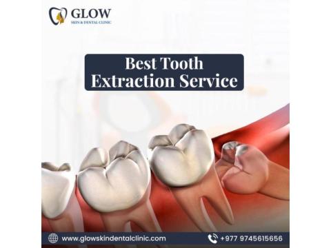 Best Tooth Extraction Service in Kathmandu