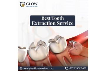 Best Tooth Extraction Service in Kathmandu