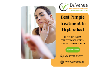 Best Pimple Treatment Near Me | Dr. Venus