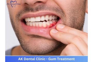 Modern & Reliable Dental Clinic in Vile Parle East | AK Dental Clinic