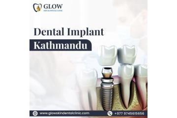 Best Dental Implant Kathmandu