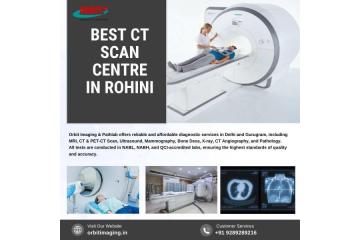Best CT Scan Centre in Rohini - Orbit Imaging