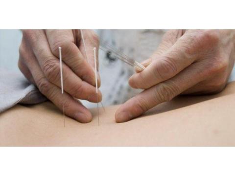 Acupuncture for Weight Control – Natural and Effective Weight Management 