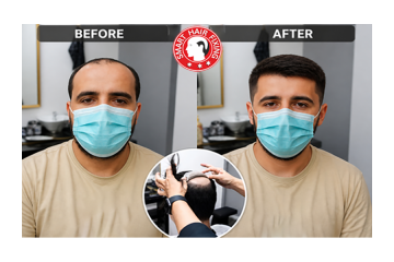 Smart Hair Fixing Oman – Get Your Natural Hair Look Back
