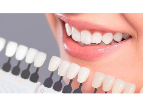 Porcelain Veneers with Durable and Natural Results