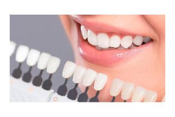 Porcelain Veneers with Durable and Natural Results